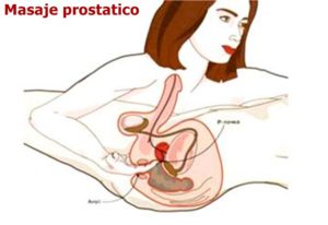 Masaje prostático Masaje prostático